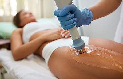 Cellulite leg treatment - 5 sessions